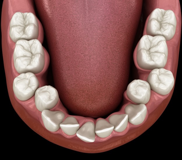 Best ways to know How Many Teeth Do Humans Have 1 how many teeth do humans have