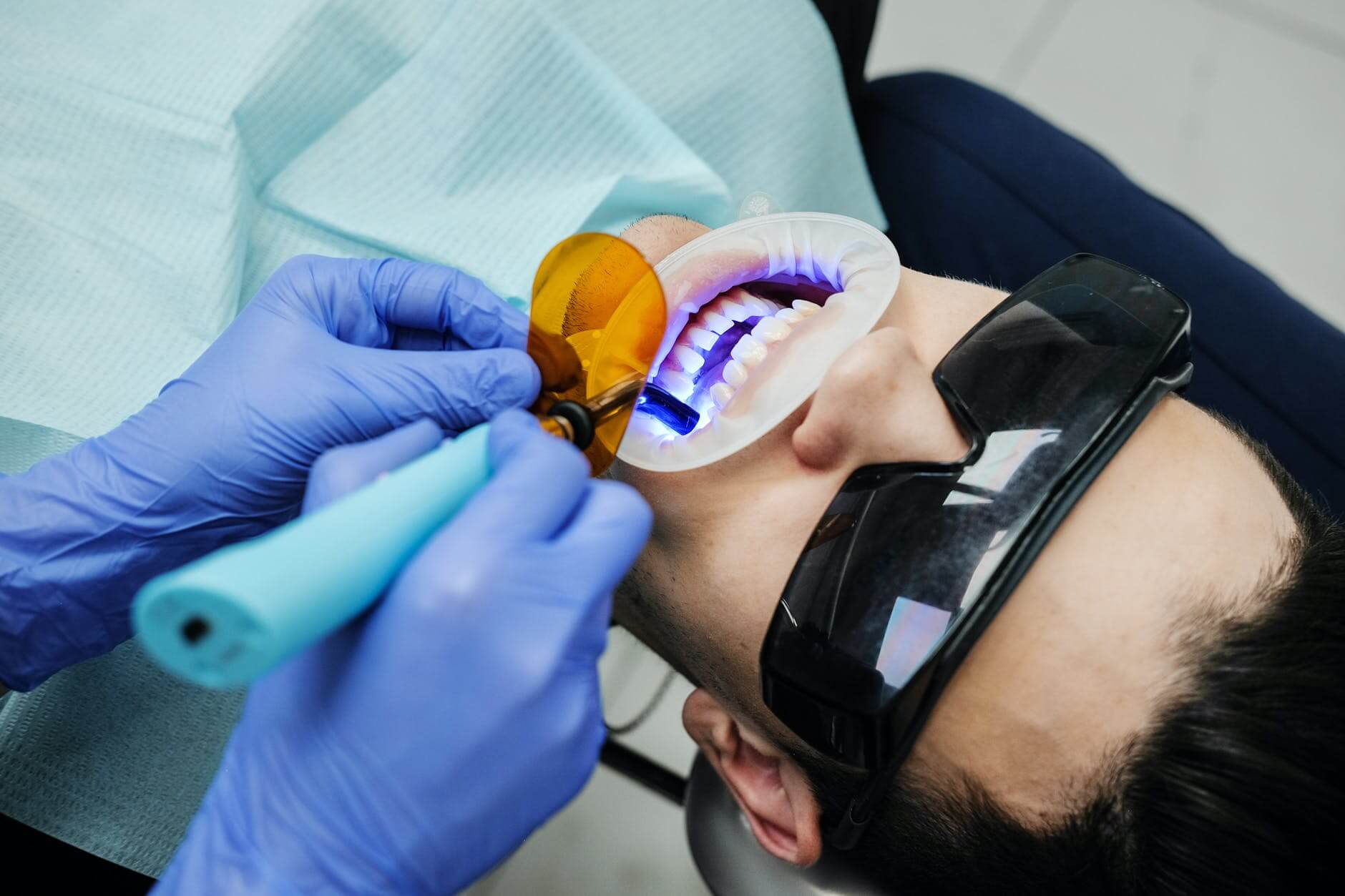 7 Important Facts About Wisdom Teeth And Tooth Removal 7 pexels photo 5434020 1