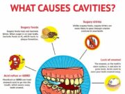 How to Tell If You Have a Cavity?What does a cavity Look like what does a cavity look like