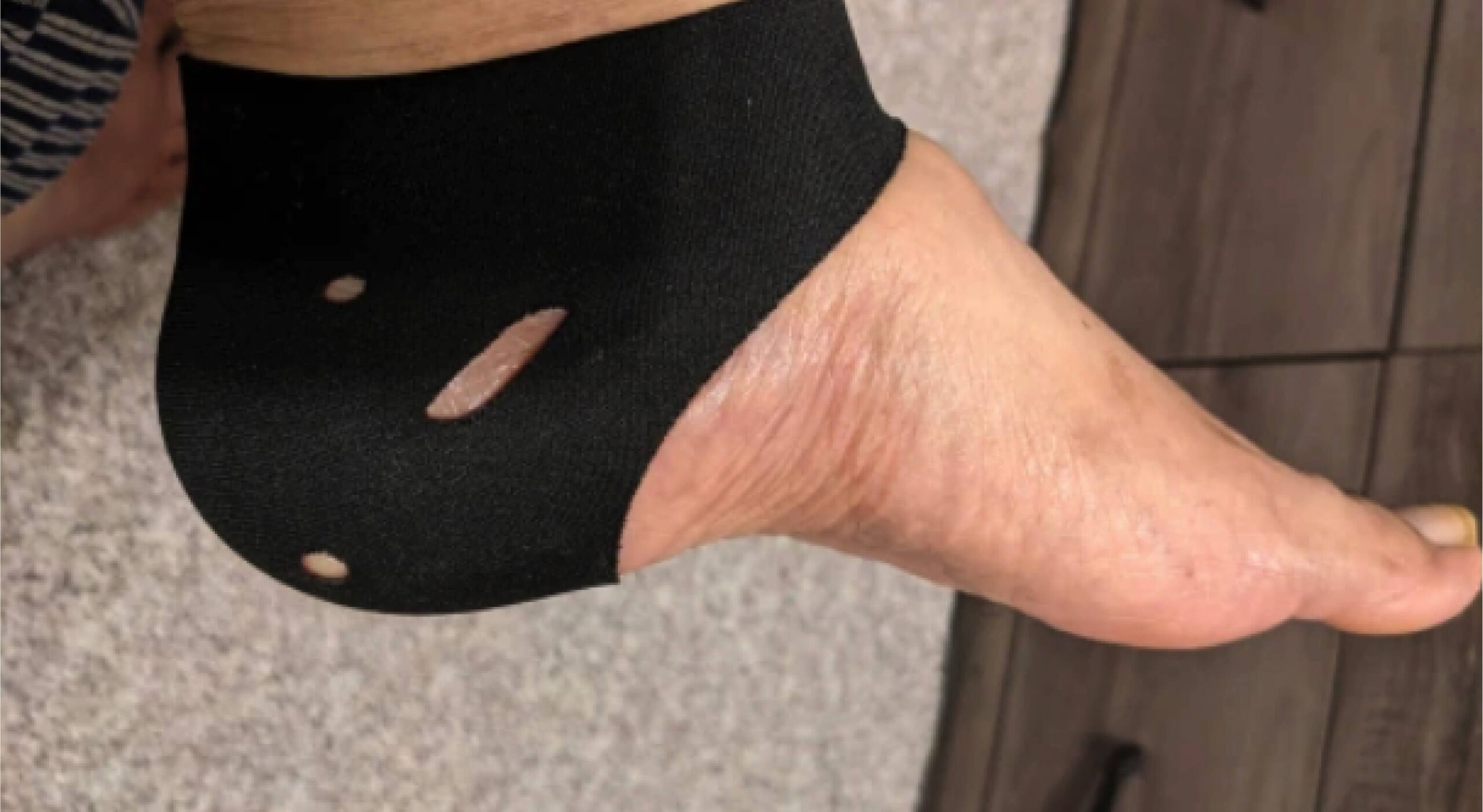 Heel Fix Pro Review 2022 - You Should Read This First. 4 Heel Fix Pro Review